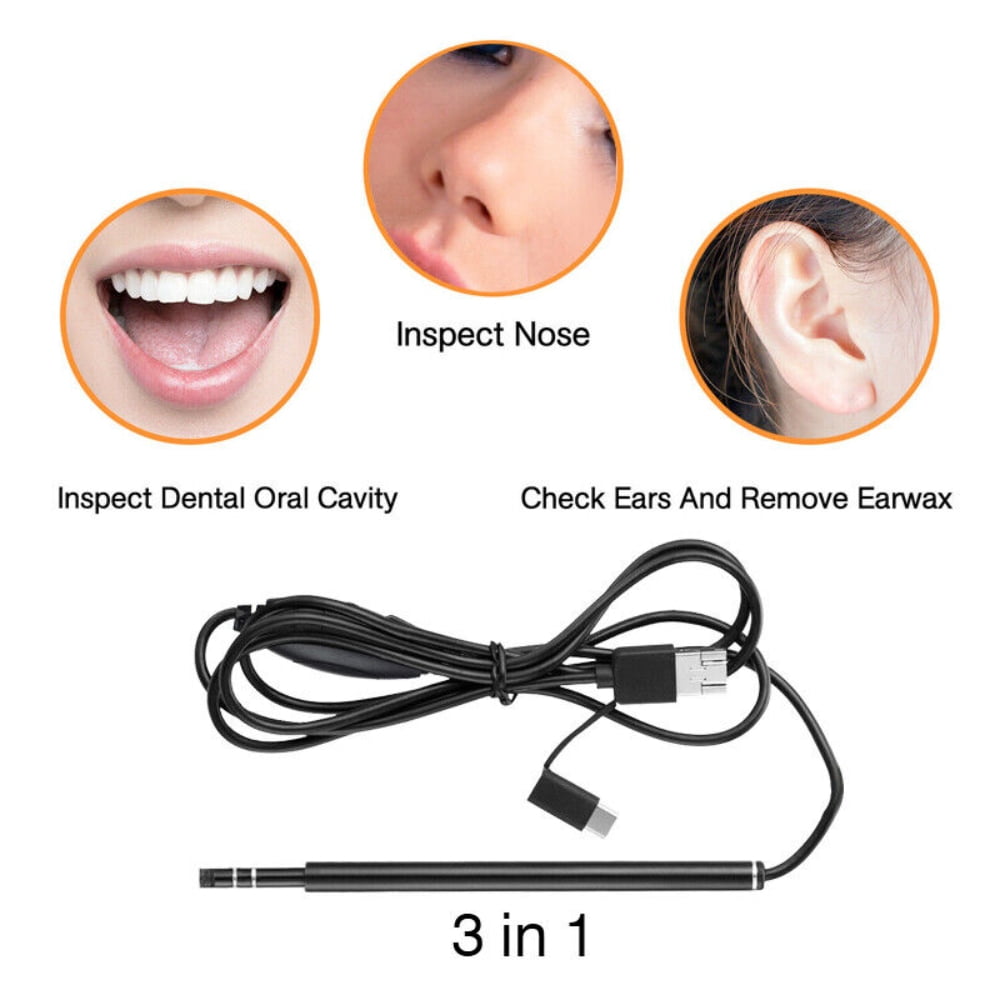 Otoscope Ear Cleaning Camera,DFITO Earwax Removal Kit with Camera Wireless Ear Scope Endoscope Ear Wax Remover Tool