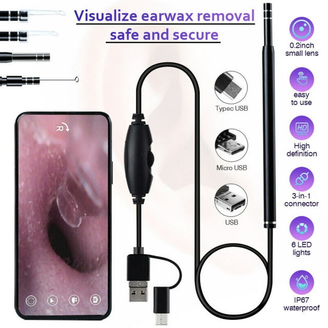 DFITO LED Ear Endoscope HD Otoscope Ear Wax Cleaning Camera Tool Cleaner Removal Kit Earwax Remover Tool Wireless Wifi Ear Cleaning Camera
