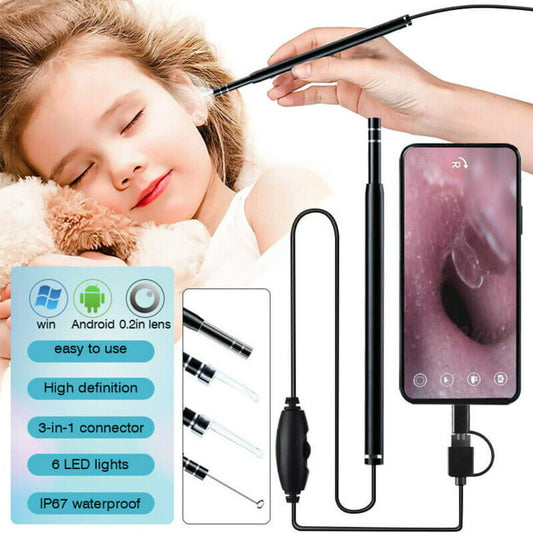 DFITO LED Ear Endoscope HD Otoscope Ear Wax Cleaning Camera Tool Cleaner Removal Kit Earwax Remover Tool Wireless Wifi Ear Cleaning Camera