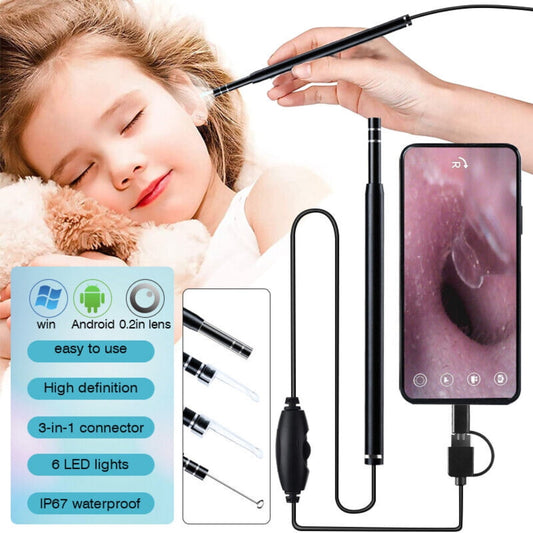 Otoscope Ear Cleaning Camera,DFITO Earwax Removal Kit with Camera Wireless Ear Scope Endoscope Ear Wax Remover Tool